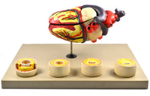 Load image into Gallery viewer, Heart: Heart Condition Model
